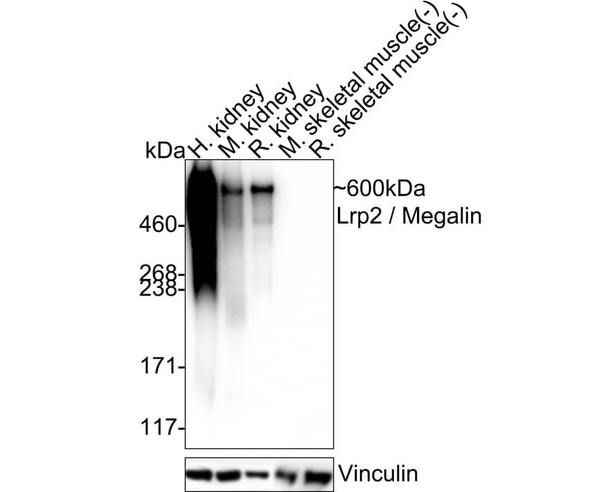 LRP2 Antibody (PSH04-52) Western Blot: LRP2 Antibody (PSH04-52) [NBP3-32546]