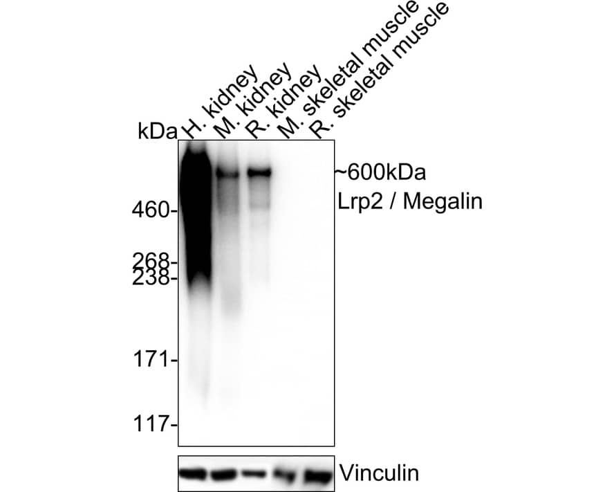 LRP2 Antibody (PSH04-52)