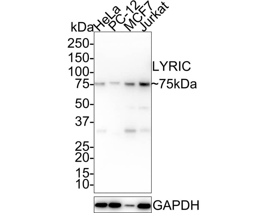 Metadherin Antibody (C6-C10-R)