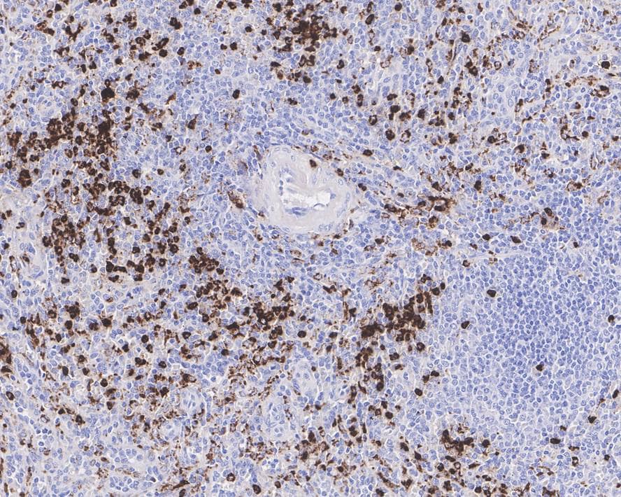 Lysozyme Antibody (A5A8-R)