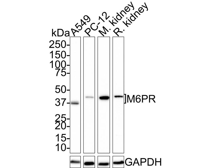 CD-M6PR Antibody (PSH01-06)