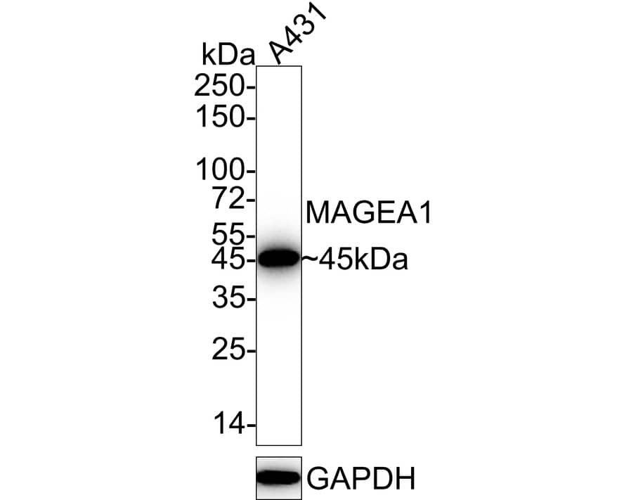 MAGEA1 Antibody (PD00-50)