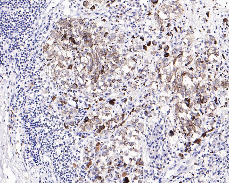 MAGEA1 Antibody (PD00-50)