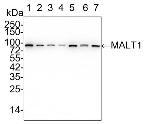 MALT1 Antibody (PSH02-31)