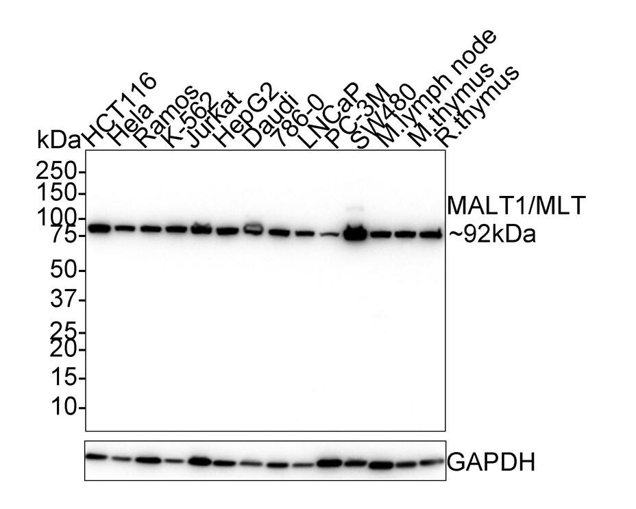 MALT1 Antibody (PSH02-32)