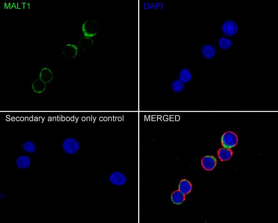 MALT1 Antibody (PSH02-32)