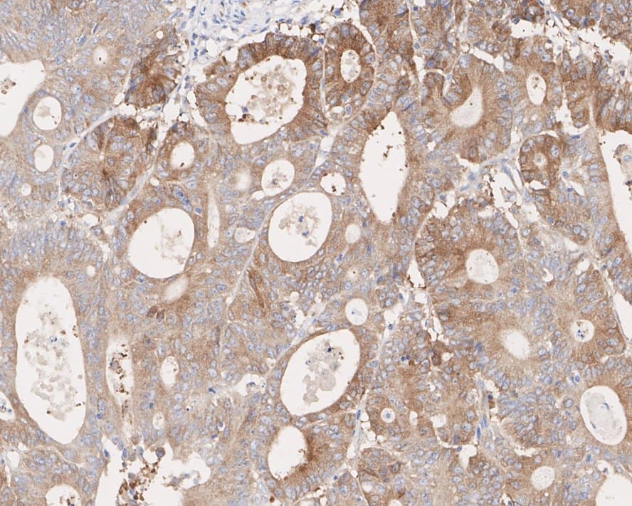 MALT1 Antibody (PSH02-32)