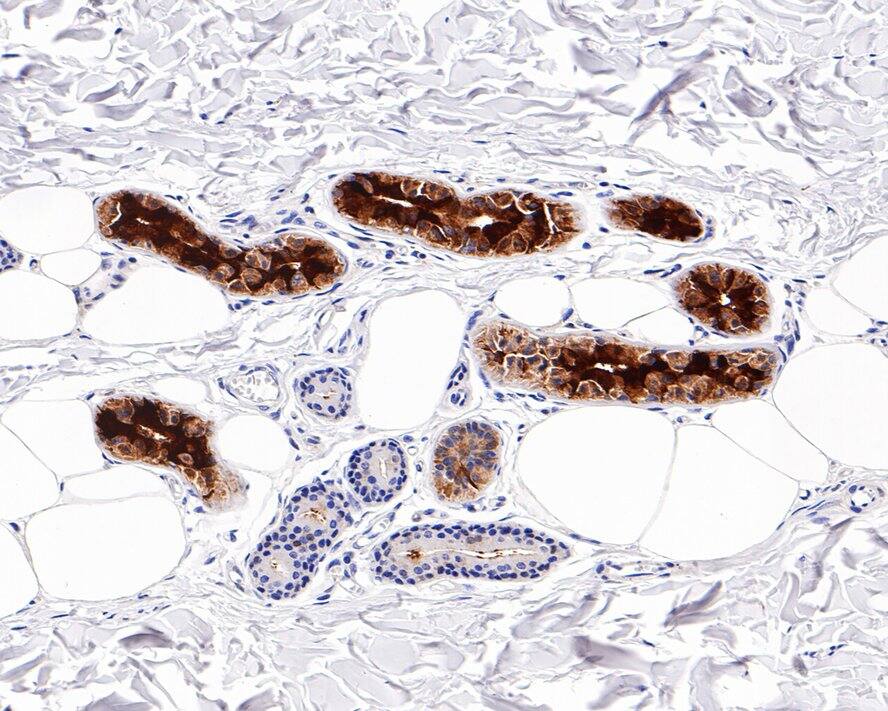 Mammaglobin A Antibody (PD00-74)