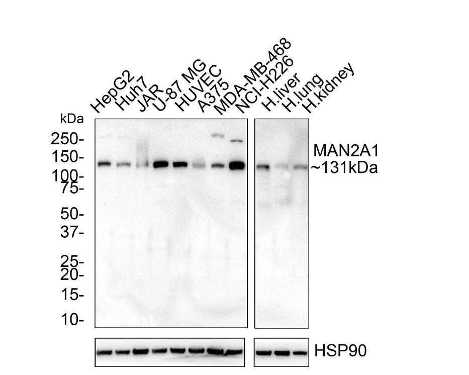 Alpha-mannosidase II Antibody (PSH02-67)