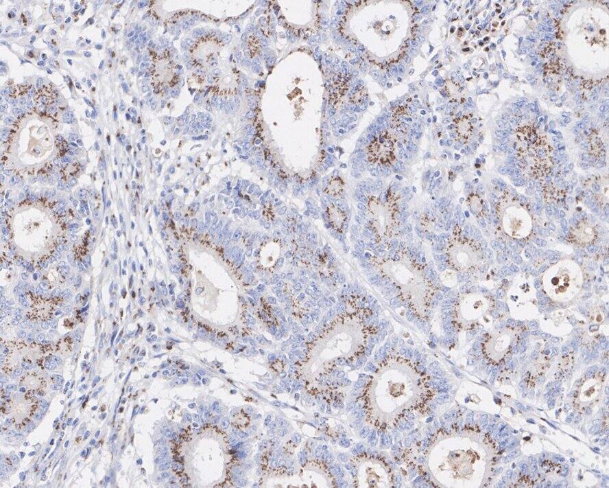 Alpha-mannosidase II Antibody (PSH02-67)