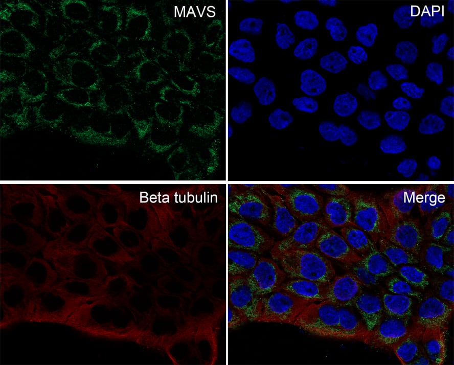 MAVS Antibody (PSH0-30)
