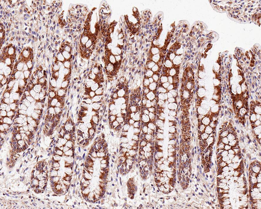 MAVS Antibody (PSH0-30)