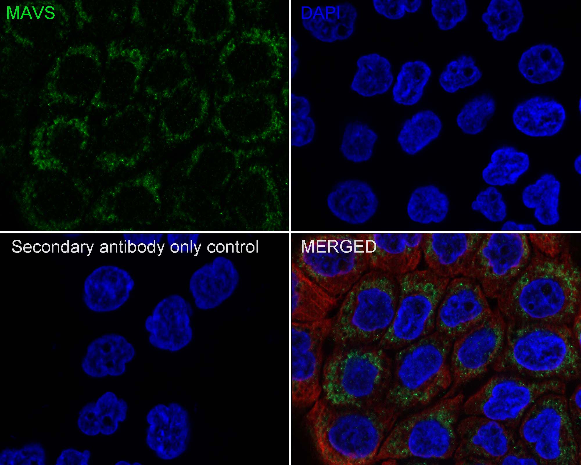 MAVS Antibody (PSH01-65)