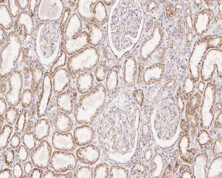 MAVS Antibody (PSH01-65)