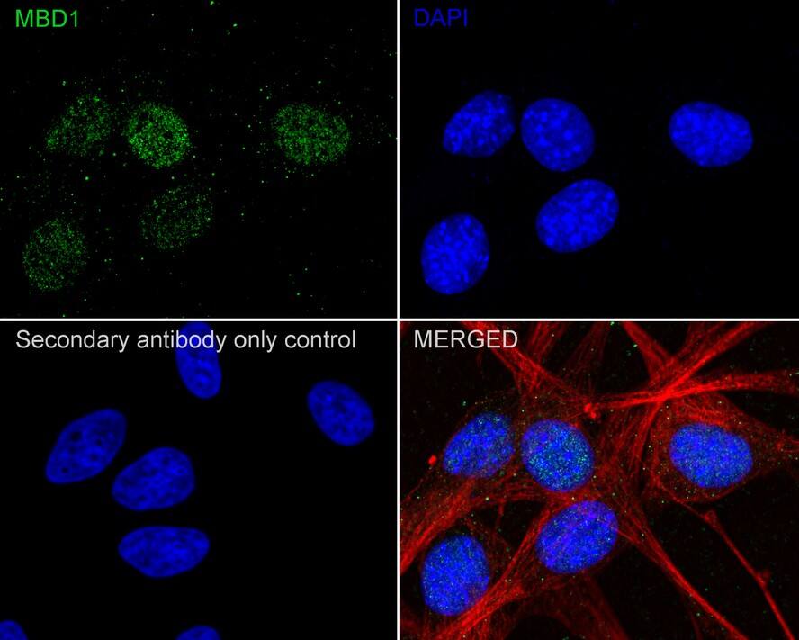 MBD1 Antibody (PSH01-79)