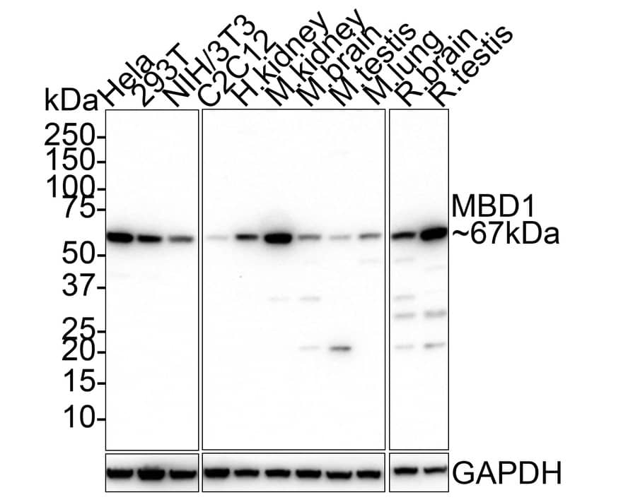 MBD1 Antibody (PSH01-78) Western Blot: MBD1 Antibody (PSH01-78) [NBP3-32572]