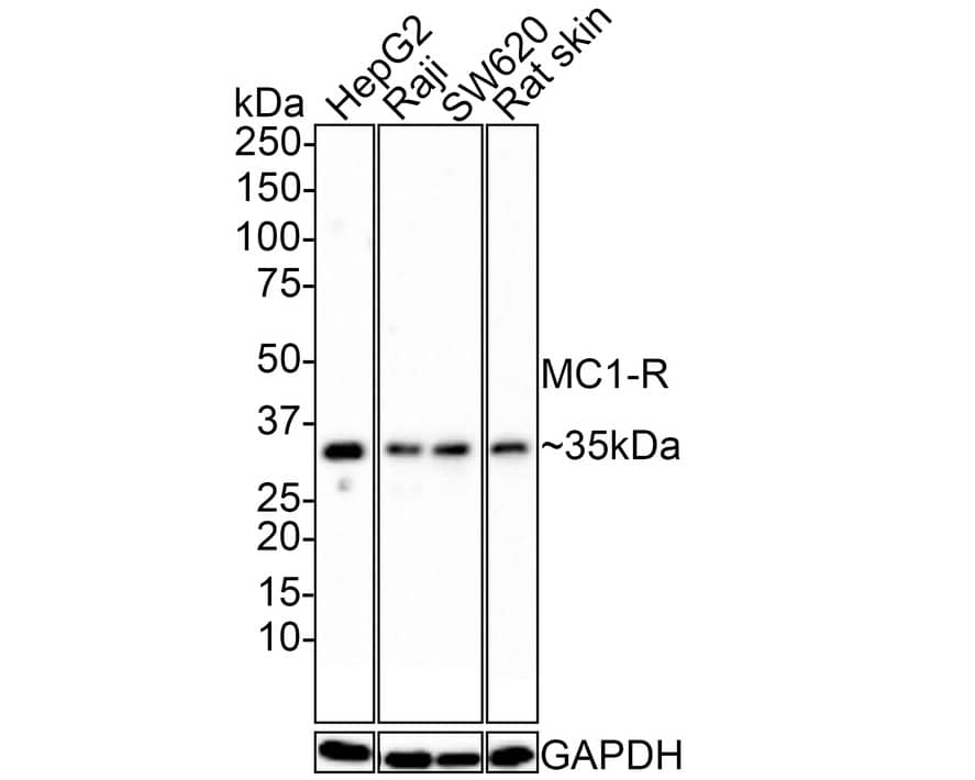 Melanocortin-1 R/MC1R Antibody (JE39-49)