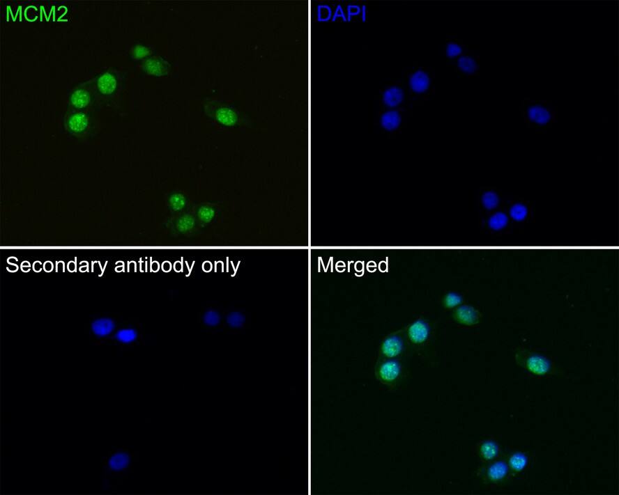 MCM2 Antibody (PD00-90)