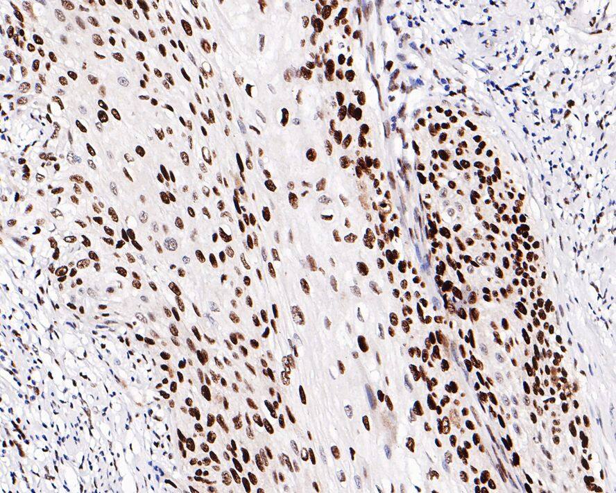 MCM2 Antibody (PD00-90)