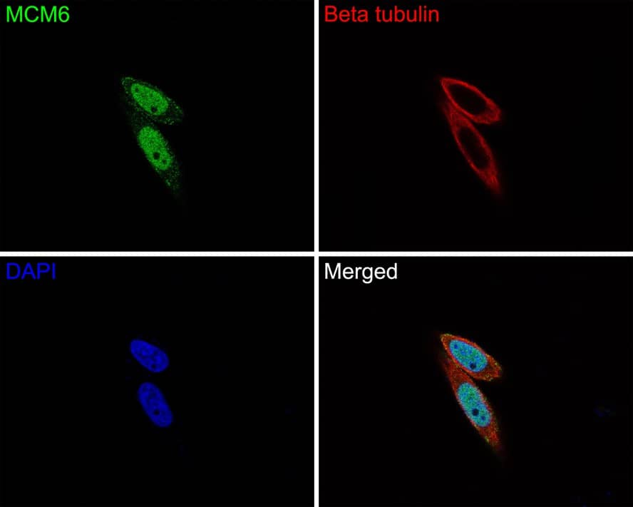 MCM6 Antibody (JE65-68)