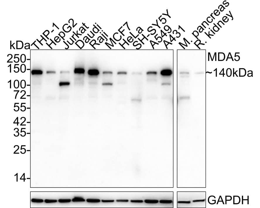 MDA5 Antibody (PSH03-56)