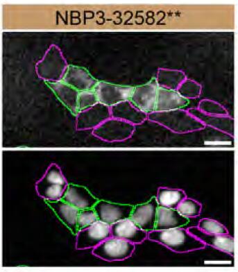 MDH1 Antibody (JE35-03) MDH1 Specificity is Shown by Immunocytochemistry in Knockout Cell Line.
