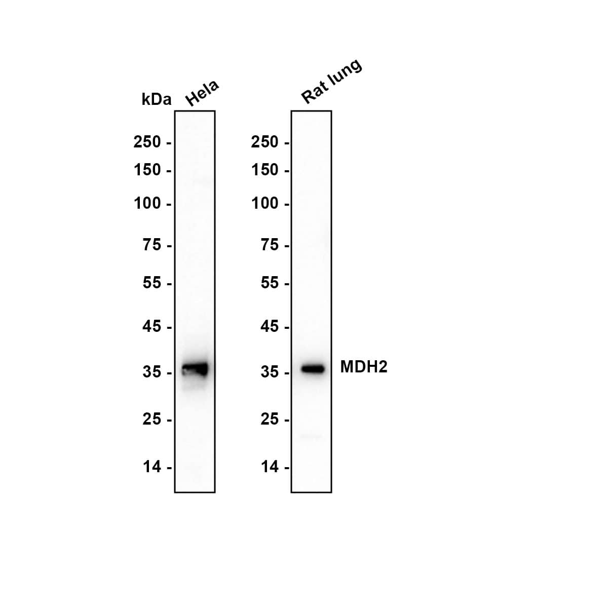 MDH2 Antibody (JE64-68) Western Blot: MDH2 Antibody (JE64-68) [NBP3-32583]
