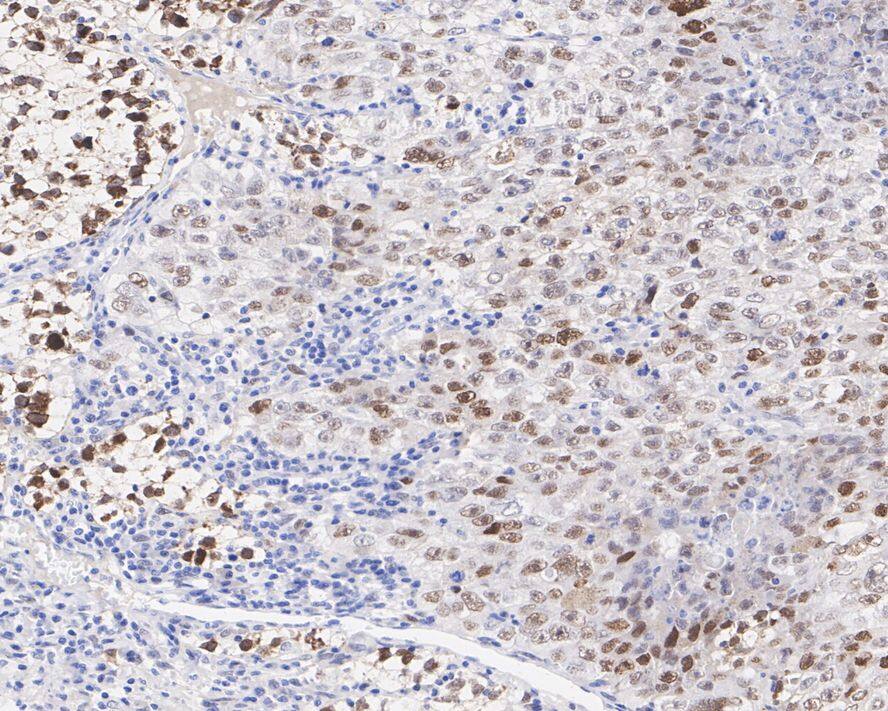 MDM2/HDM2 Antibody (A10E11-R)