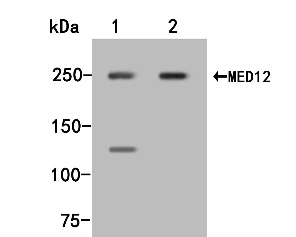MED12 Antibody Western Blot: MED12 Antibody [NBP3-32585]