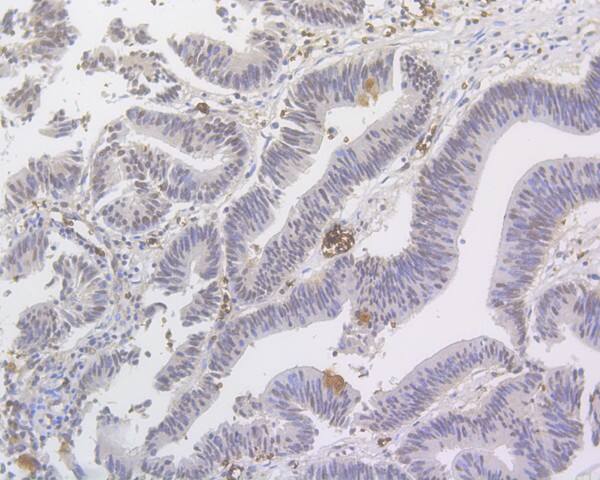 MED12 Antibody