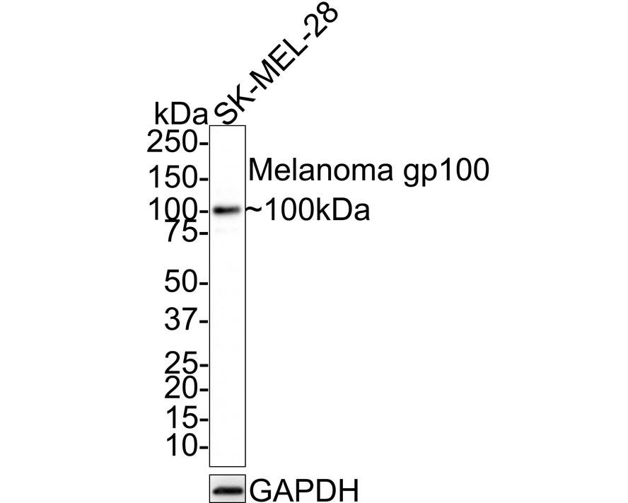 PMEL17/SILV Antibody (JE42-47)