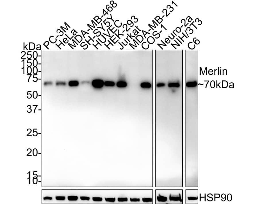 NF2/Merlin Antibody (PSH02-52)