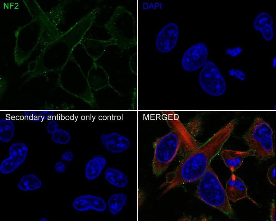 NF2/Merlin Antibody (PSH02-52)