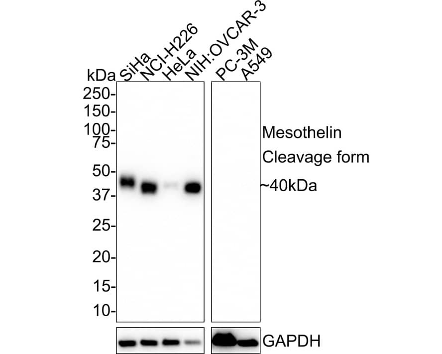 Mesothelin Antibody (PSH02-30)