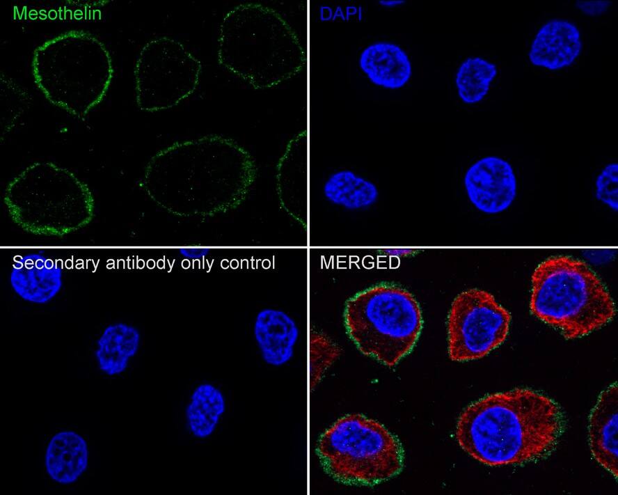 Mesothelin Antibody (PSH02-30)