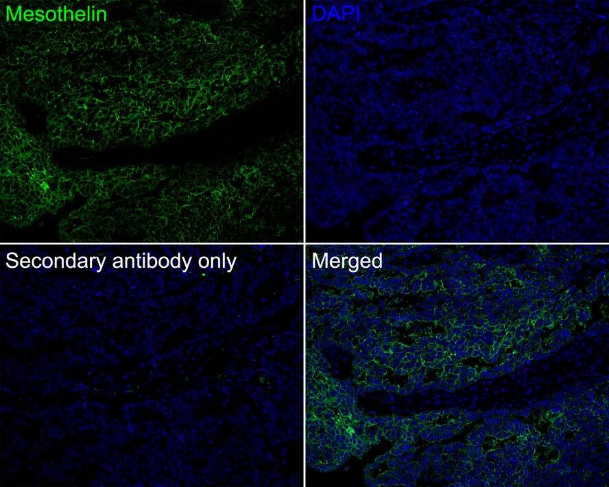 Mesothelin Antibody (PSH02-30)