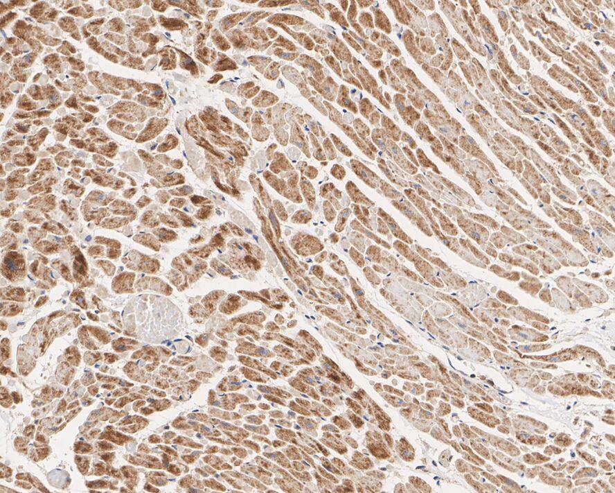 EFHA1 Antibody (PSH01-84)