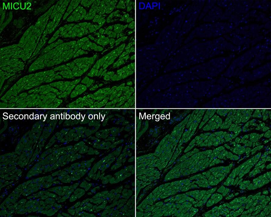 EFHA1 Antibody (PSH01-84)