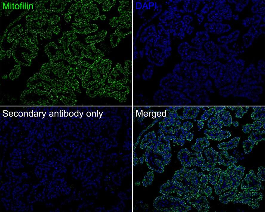 Mitofilin Antibody (PSH01-18)