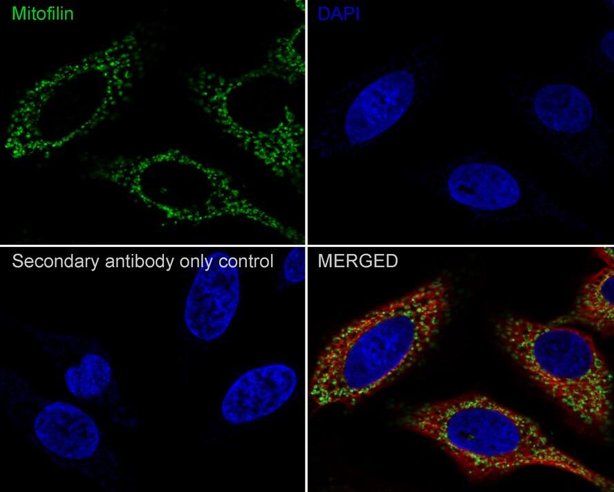 Mitofilin Antibody (PSH01-19)