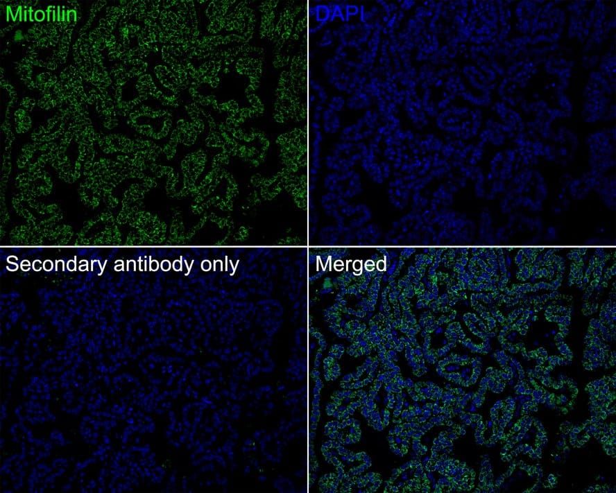 Mitofilin Antibody (PSH01-19)