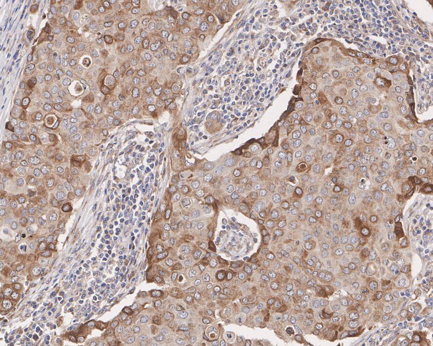 DEGS1 Antibody (PSH02-54)