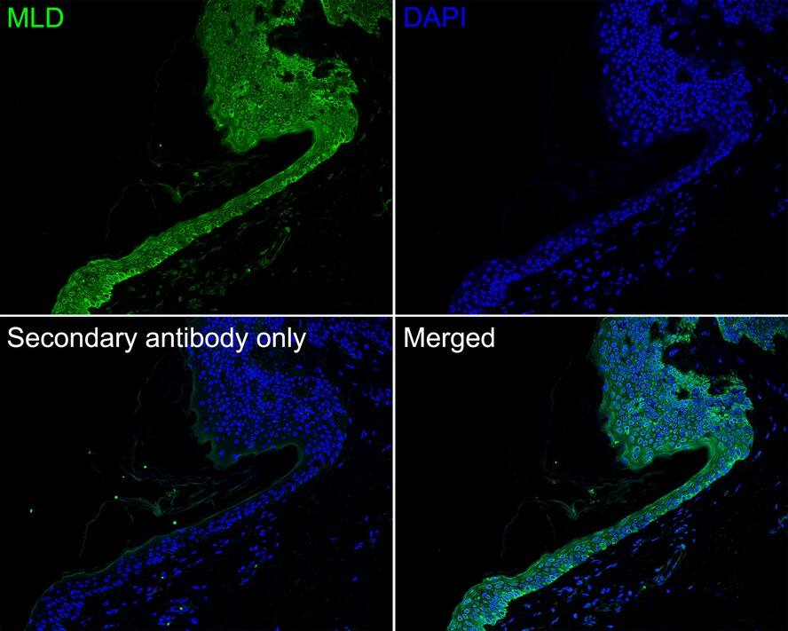 DEGS1 Antibody (PSH02-54)