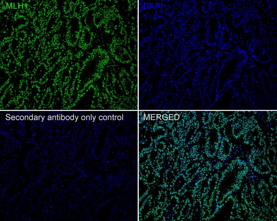 MLH1 Antibody (PSH01-74)