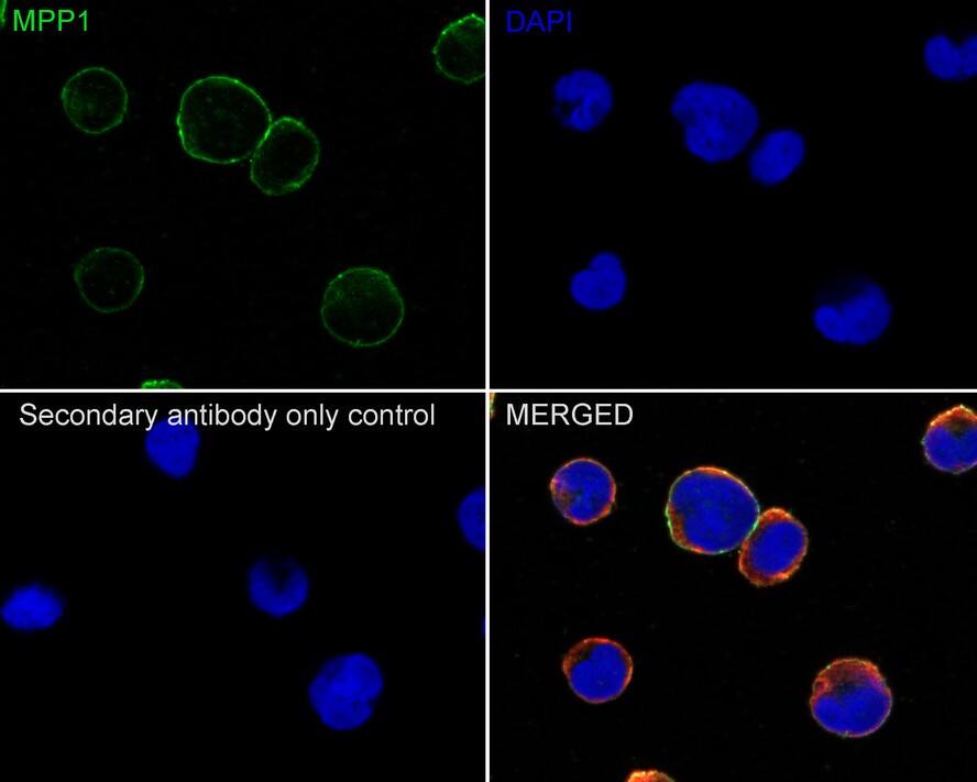 MPP1 Antibody (PSH02-69)