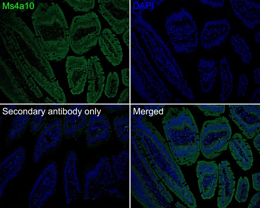 MS4A10 Antibody (PSH0-71)