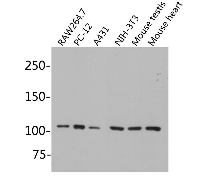 MSH2 Antibody (10G3-R)