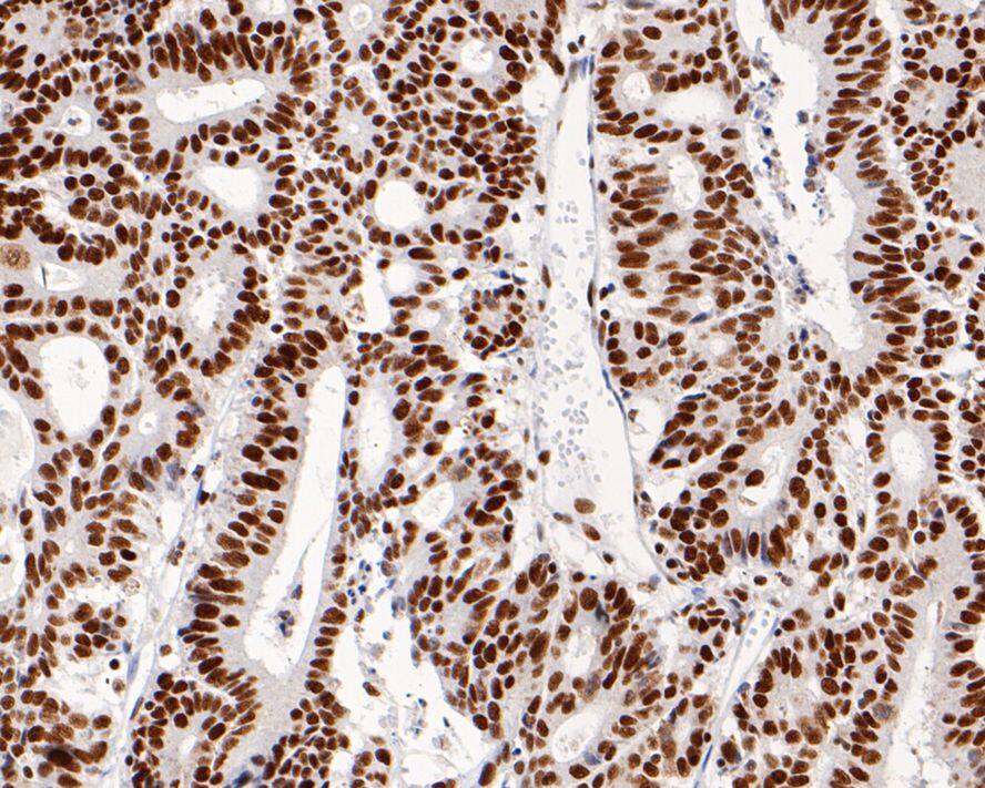 MSH2 Antibody (10G3-R)
