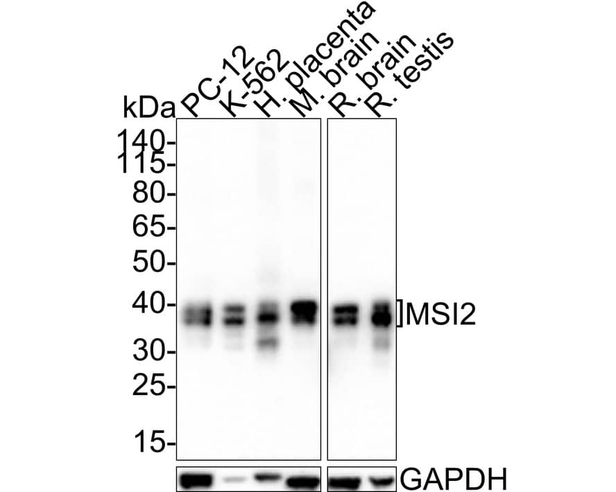 Musashi-2 Antibody (PSH01-17)