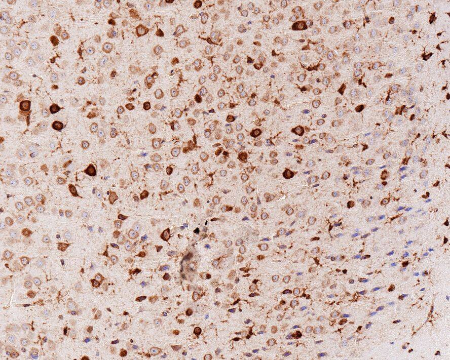 Musashi-2 Antibody (PSH01-17)